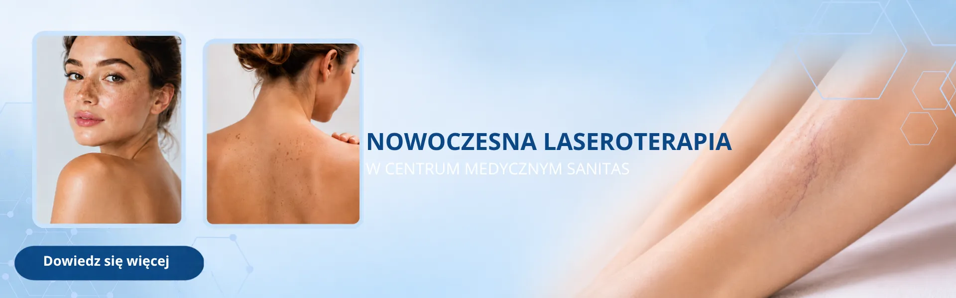 treść prezentowana graficznie